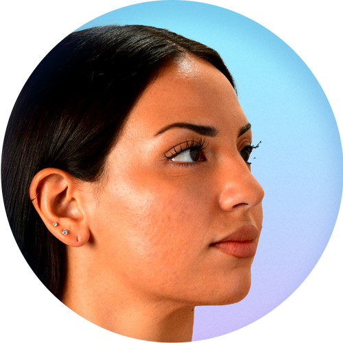 A profile view of a young woman’s face who has beautiful, clear skin which represents skin after using Liquid Oxygen